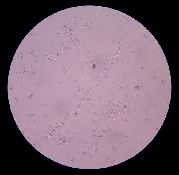 Vertakking ontluikende gistcellen met pseudohyphae in urine — Stockfoto