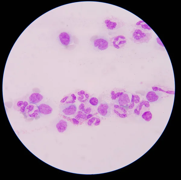 Blood smear is often used as a follow-up test to abnormal result — Stock Photo, Image