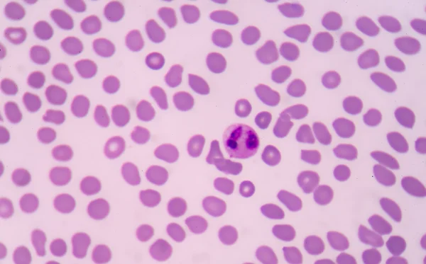 白血球細胞. — ストック写真