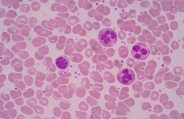 Белые клетки крови . — стоковое фото