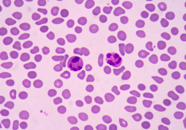 blood smear is often used as a follow-up test to abnormal result