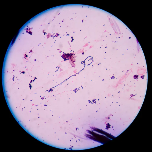 Gram positive cocci in chain. — Stock Photo, Image