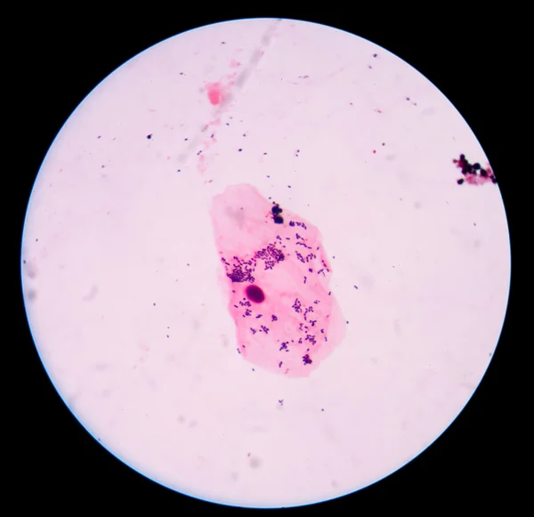 Gram staining, also called Gram's method, is a method of differe — Stock Photo, Image