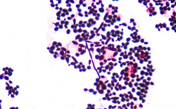 Cellules de levure bourgeonnantes ramifiées avec pseudohyphes dans l'urine gram st — Photo