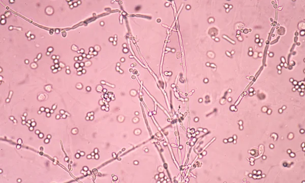 Branching budding yeast cells with pseudohyphae in urine  fine w — Stock Photo, Image