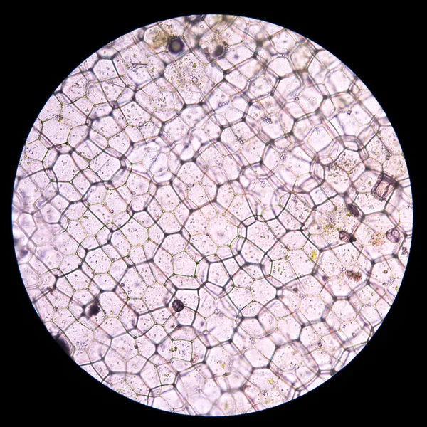 굴 식물 세포입니다. 현미경 식물 세포 — 스톡 사진
