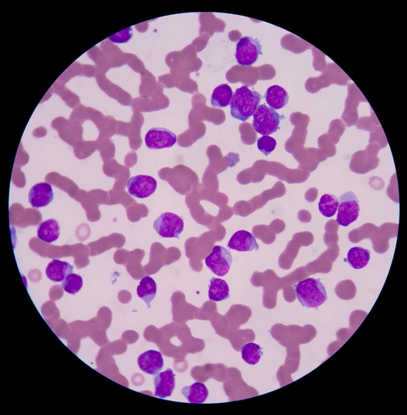 Smaller red to pink normal red blood cells or erythrocytes. — Stock Photo, Image