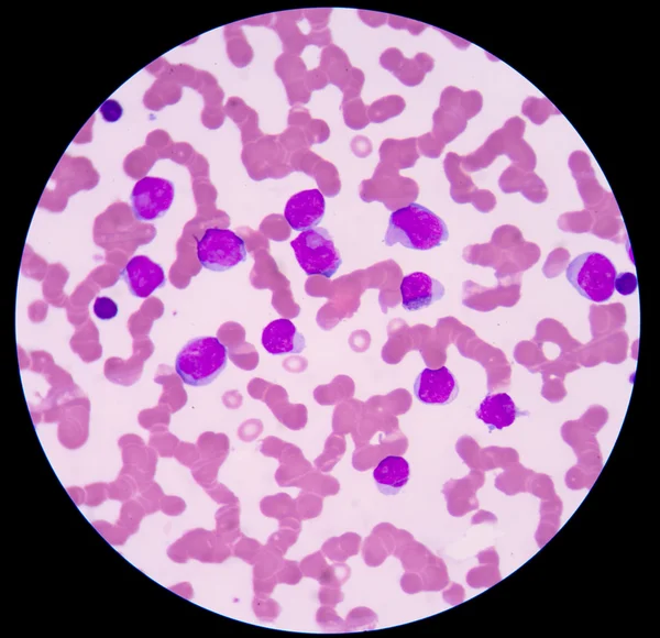 Eritrociti o globuli rossi normali da rossi a rosa più piccoli . — Foto Stock