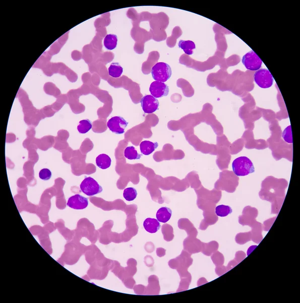 Eritrócitos ou eritrócitos vermelhos a rosas normais menores . — Fotografia de Stock