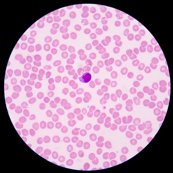 小さい赤ピンク正常赤血球または赤血球. — ストック写真