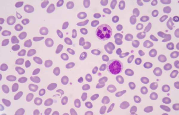 Medical background red blood cells. — Stock Photo, Image