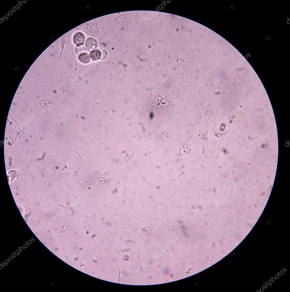 Моча микроскопия бактерии. Бактерии в осадке мочи. Центрифугирование мочи для микроскопии осадка мочи. Бактерии кокки в моче. Моча микроскопия бактерии.