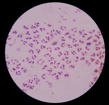 Kimyasal ve hücresel faktörler inflamatuar respo katılan