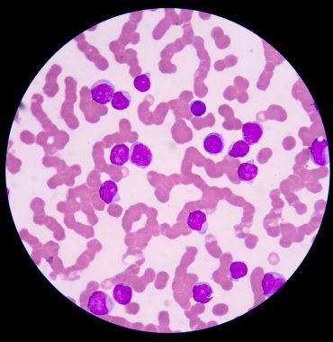 Tıbbi geçmişi kırmızı kan hücreleri.