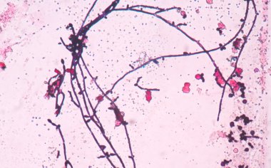 Maya hücreleri pseudohyphae idrar gram St ile filizlenen dallanma