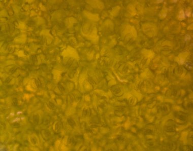 bitki hücreleri mikroskop altında