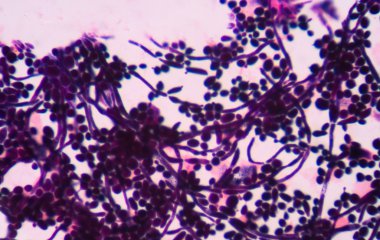 Maya hücreleri pseudohyphae idrar gram St ile filizlenen dallanma