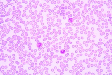  Kan yayması genellikle bir izleme testi anormal resul için kullanılır