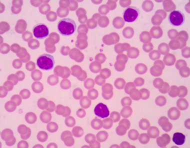 Lenfosit. Bağışıklık hücresi. Antikor üreten hücre. B-lymphocyte o