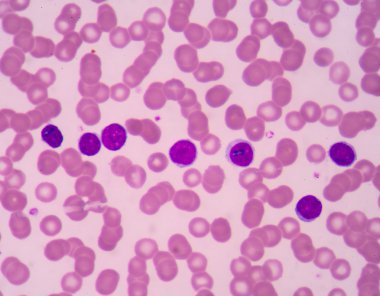 Lenfosit. Bağışıklık hücresi. Antikor üreten hücre. B-lymphocyte o