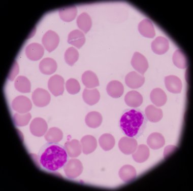 Lenfosit. Bağışıklık hücresi. Antikor üreten hücre. B-lymphocyte o