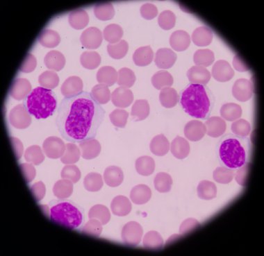 Lenfosit. Bağışıklık hücresi. Antikor üreten hücre. B-lymphocyte o
