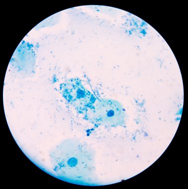 Maya hücreleri pseudohyphae idrar gram St ile filizlenen dallanma