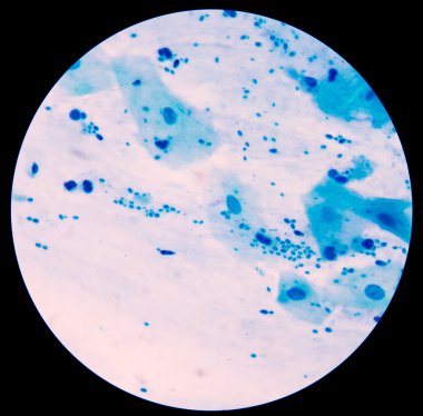 Maya hücreleri pseudohyphae idrar gram St ile filizlenen dallanma
