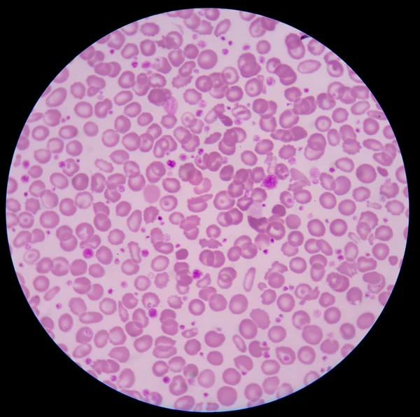 Medical background red blood cells. — Stock Photo, Image