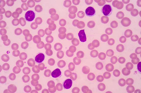 Lenfosit. Bağışıklık hücresi. Antikor üreten hücre. B-lymphocyte o — Stok fotoğraf