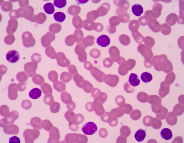 Lenfosit. Bağışıklık hücresi. Antikor üreten hücre. B-lymphocyte o — Stok fotoğraf