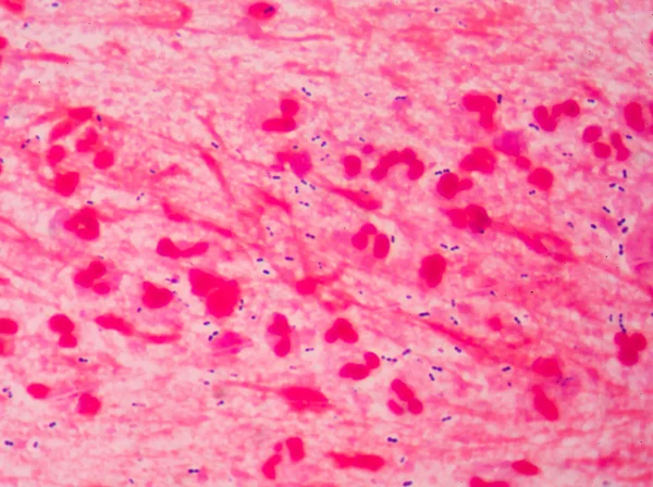 Bacteriano ciência médica fundo . — Fotografia de Stock