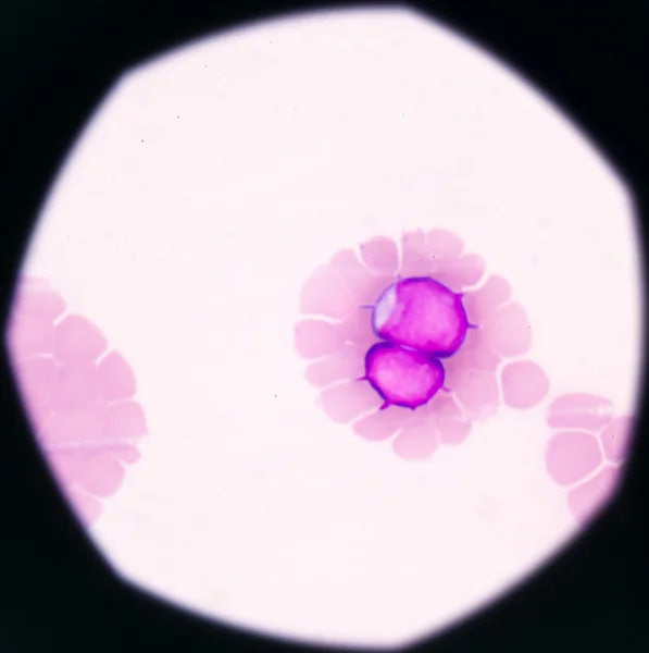 Медицинская наука показывает доменные клетки (ОМЛ) ) — стоковое фото