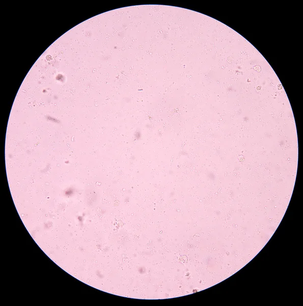 Fresh Bacteria in Urine analysis. Stock Photo by ©toeytoey 97030918