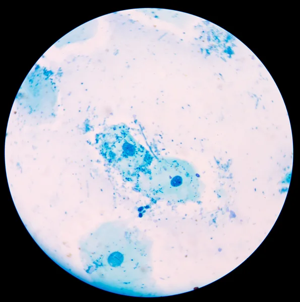 尿グラム st で桑と酵母細胞を出芽の分岐 — ストック写真