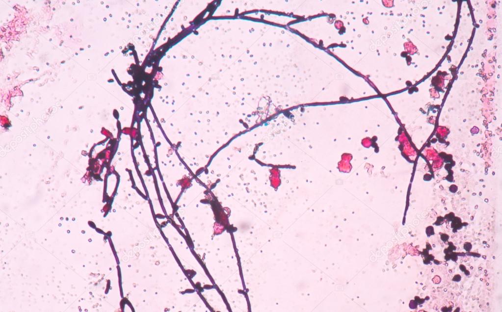 Branching budding yeast cells with pseudohyphae in urine gram st — Stock Photo © toeytoey 97030394