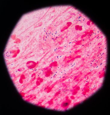 Mikro bakteri hücre