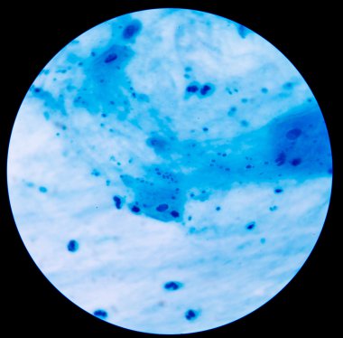Maya hücreleri pseudohyphae balgam gram s ile filizlenen dallanma