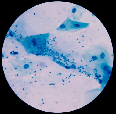 Maya hücreleri pseudohyphae balgam gram s ile filizlenen dallanma