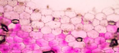 Pembe bitki hücreleri mikroskop altında.