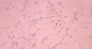 Taze Branching mayası 