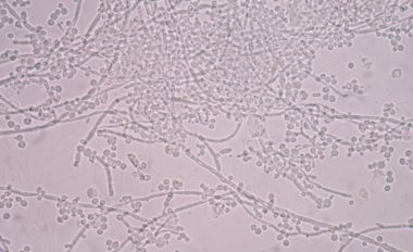 Taze Maya hücreleri filizlenen dallanma