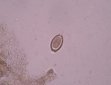 dışkıda parazit yumurta 