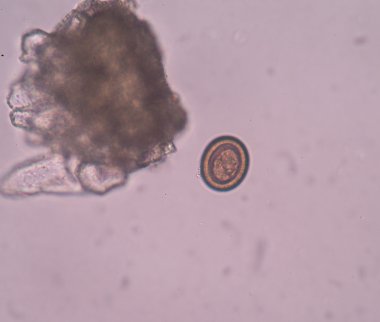 dışkıda parazit yumurta 