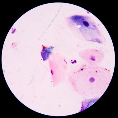 Kırmızı bakteri hücreleri