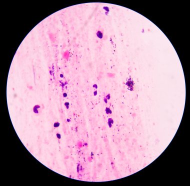 Bakteriler mavi hücreler