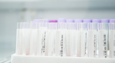 Laboratuvarda Test Tübü.