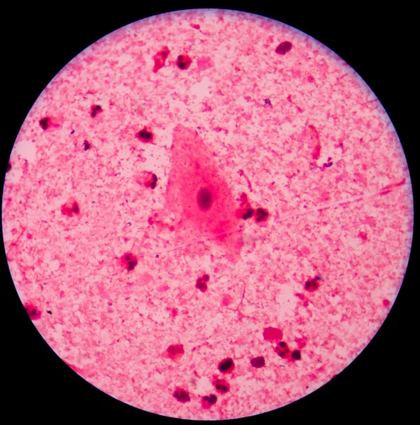 Bakterienzelle im Mikro — Stockfoto