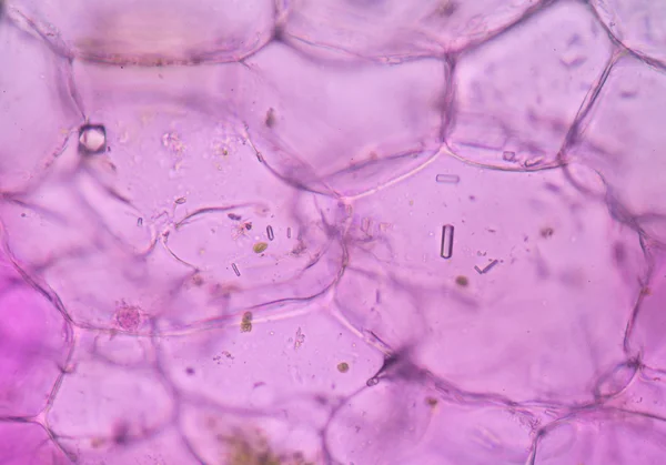 Roze plantencellen onder Microscoop. — Stockfoto