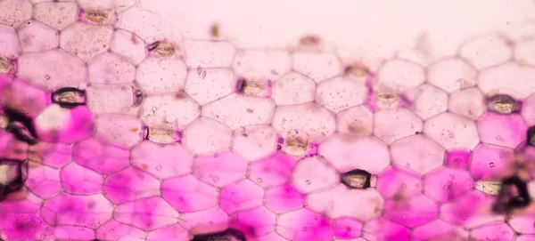 Células vegetais rosa ao microscópio . — Fotografia de Stock